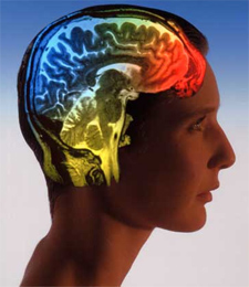 Brain scan